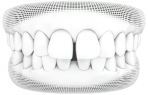 Invisalign<sup>®</sup> Treatment