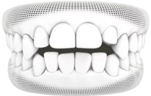 Invisalign<sup>®</sup> Treatment