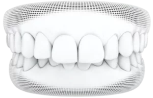 Invisalign<sup>®</sup> Treatment