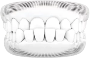 Invisalign<sup>®</sup> Treatment